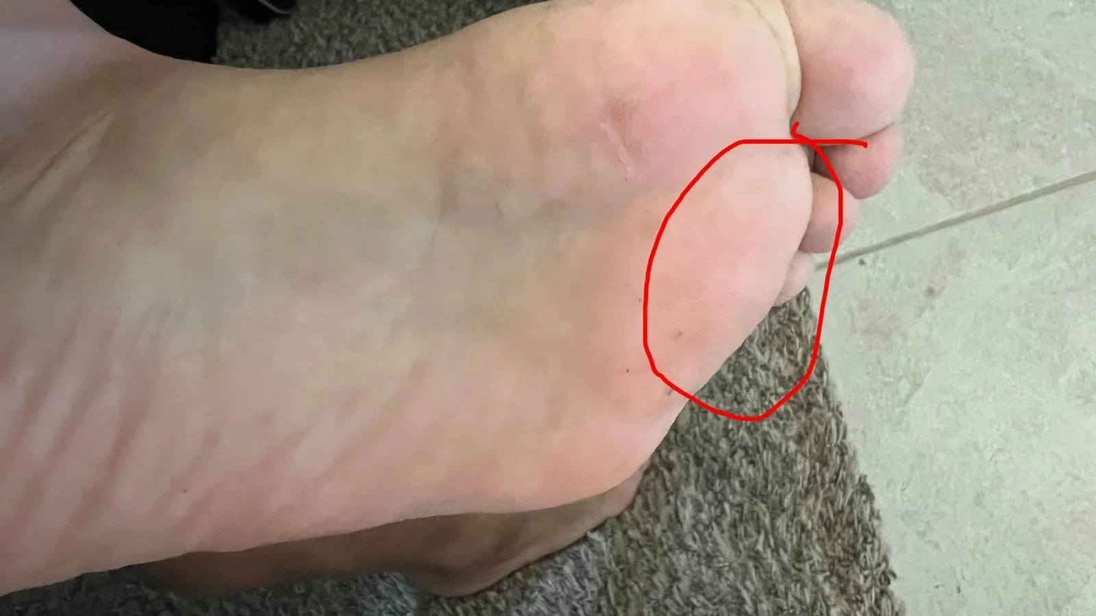 May be an image of acupuncture