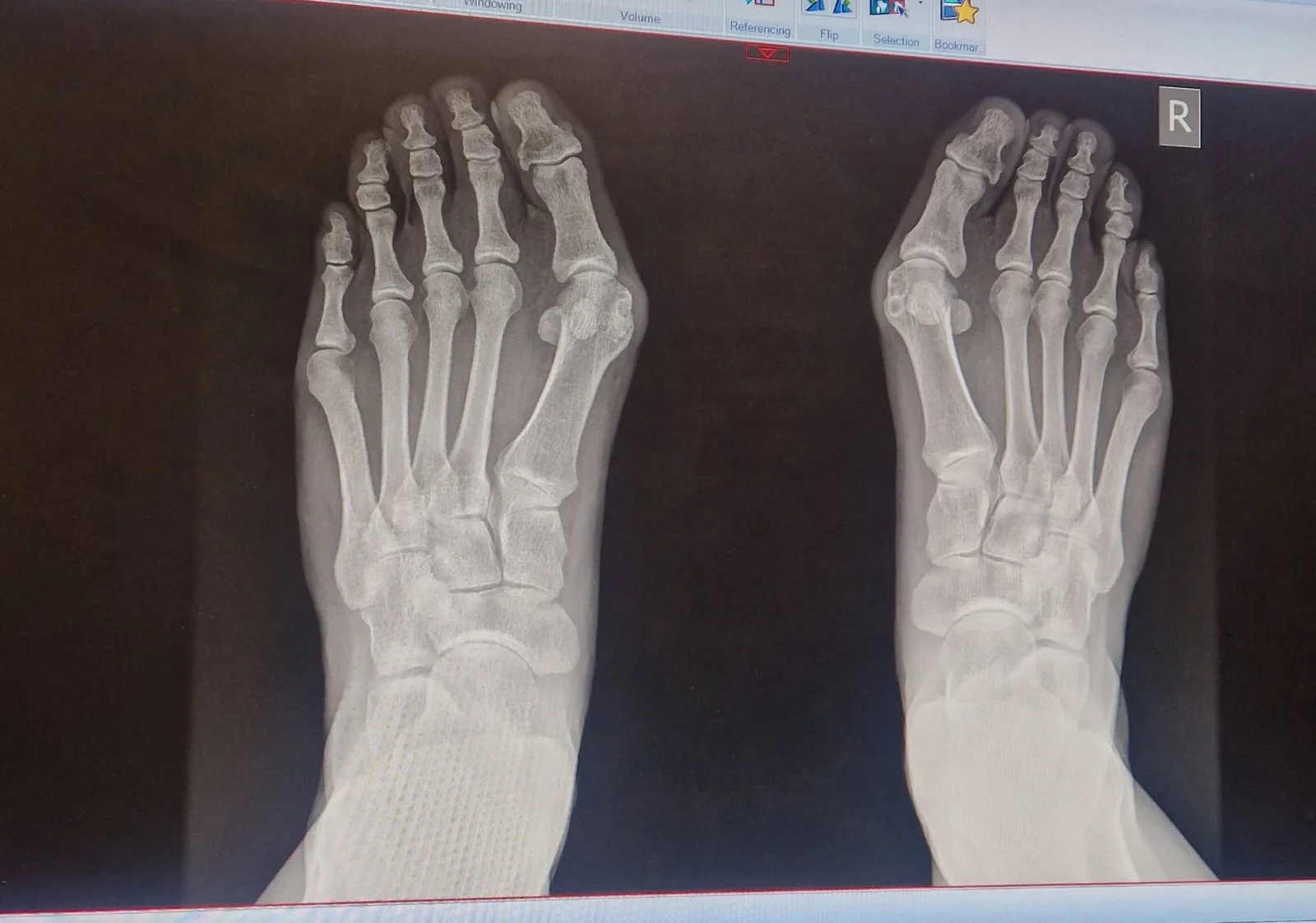May be an image of bone and xray