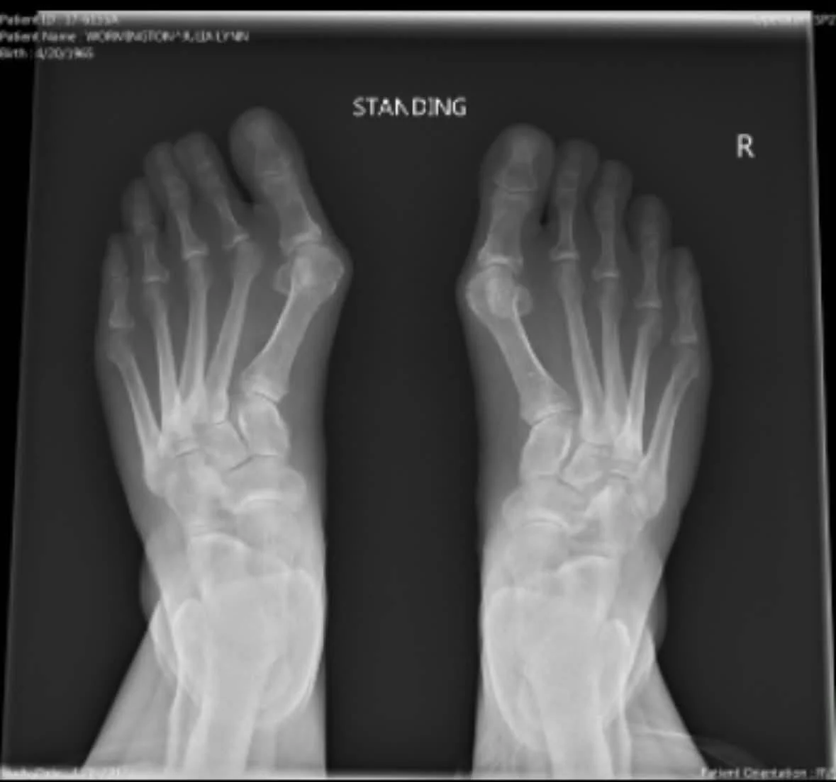 May be an image of bone and xray