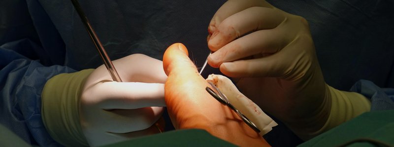 Walking & Weight Bearing After Surgery